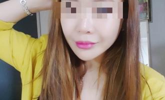 미앤미 신촌점 슈링크 여우주사 턱끝필러 후기